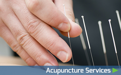 Acupuncture Services